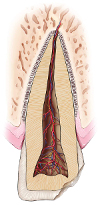 illustration of injured tooth - traumatic dental injuries
