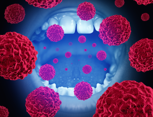 Oral Cancer Detection by Dentists is Significantly on the Rise